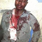 Insécurité à Goma : poignardé, un journaliste frôle la mort